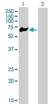 Anti-PRKCSH Mouse Polyclonal Antibody