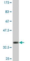 Anti-WTAP Mouse Monoclonal Antibody [clone: 1B11]