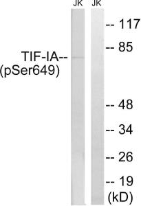 Western blot analysis of lysates from Jurkat cells treated with starved 24h using Anti-TIF-IA (phospho Ser649) Antibody. The right hand lane represents a negative control, where the antibody is blocked by the immunising peptide