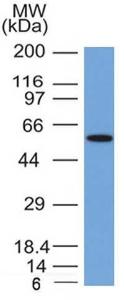 Western blot analysis of MCF-7 cell lysate using Anti-Occludin Antibody [OCLN/2181]