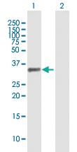 Anti-PDLIM1 Mouse Polyclonal Antibody