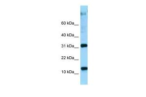 Anti-RPL22 Rabbit Polyclonal Antibody