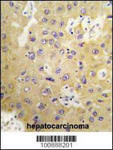 Anti-SGK3 Rabbit Polyclonal Antibody (FITC (Fluorescein Isothiocyanate))