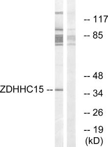 Anti-ZDHHC15 antibody