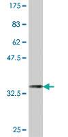 Anti-L3MBTL2 Mouse Polyclonal Antibody