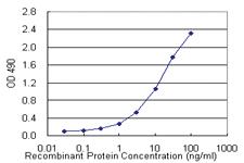 Anti-FKBP5 Polyclonal Antibody Pair