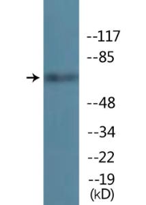 Western blot analysis of lysates from Jurkat cells treated with starved 24h using Anti-TIF-IA (phospho Ser649) Antibody