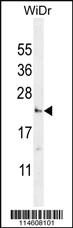 Anti-UTS2 Rabbit Polyclonal Antibody