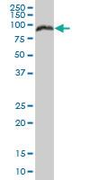 Anti-PRKCSH Mouse Polyclonal Antibody