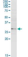 Anti-SULT1B1 Rabbit Polyclonal Antibody