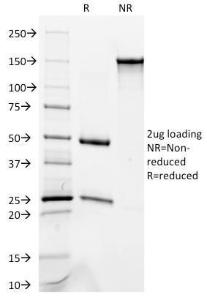 SDS-PAGE analysis of Anti-Occludin Antibody [OCLN/2181] under non-reduced and reduced conditions; showing intact IgG and intact heavy and light chains, respectively. SDS-PAGE analysis confirms the integrity and purity of the antibody