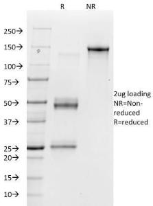 SDS-PAGE analysis of Anti-Integrin alpha V Antibody [23C6] under non-reduced and reduced conditions; showing intact IgG and intact heavy and light chains, respectively SDS-PAGE analysis confirms the integrity and purity of the antibody