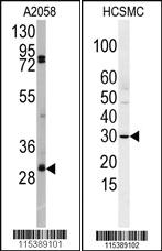 Anti-SNAI2 Rabbit Polyclonal Antibody