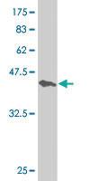 Anti-RXRA Mouse Monoclonal Antibody [clone: 3A5]