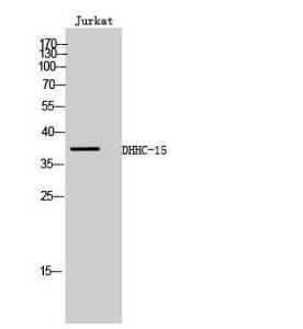 Anti-ZDHHC15 antibody