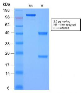 Anti-Moesin antibody