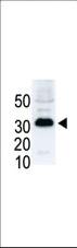 Anti-SNAI1 Rabbit Polyclonal Antibody