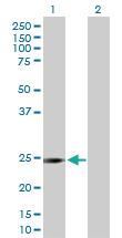 Anti-DCXR Rabbit Polyclonal Antibody