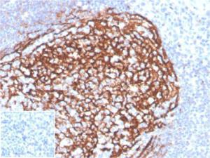 Immunohistochemical analysis of formalin-fixed, paraffin-embedded human tonsil tissue using Anti-CD21 Antibody [CR2/3990R]. Inset: PBS instead of the primary antibody. Secondary antibody negative control