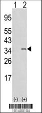 Anti-SNAI1 Rabbit Polyclonal Antibody