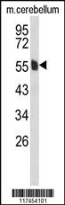 Anti-MPP6 Rabbit Polyclonal Antibody