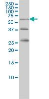 Anti-RIOK3 Mouse Monoclonal Antibody [clone: 3G11]