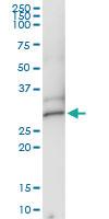 Anti-DCK Polyclonal Antibody Pair