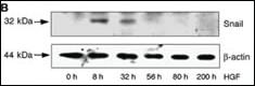 Anti-SNAI1 Rabbit Polyclonal Antibody