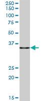 Anti-PDLIM1 Mouse Polyclonal Antibody