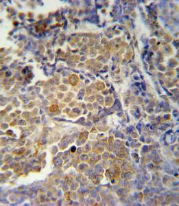 Anti-KIR2DS2 Rabbit Polyclonal Antibody (Biotin)