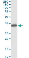 Anti-SULT1B1 Mouse Monoclonal Antibody [clone: 4C9]