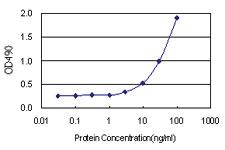 Anti-EFHC1 Polyclonal Antibody Pair