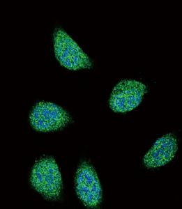 Anti-Cortisol Binding Globulin Rabbit Polyclonal Antibody (PE (Phycoerythrin))