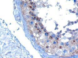 Anti-VPS28 Antibody (A82678) (10 µg/ml) staining of paraffin embedded Human Testis. Microwaved antigen retrieval with Tris/EDTA buffer pH9, HRP-staining