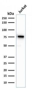 Anti-Moesin antibody