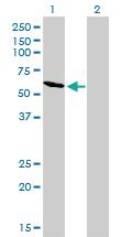 Anti-RIOK3 Mouse Monoclonal Antibody [clone: 3G11]