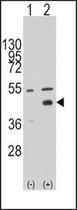 Anti-WIF1 Rabbit Polyclonal Antibody (AP (Alkaline Phosphatase))