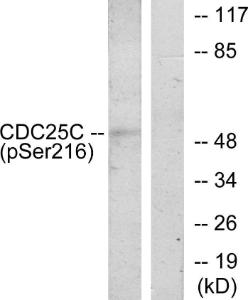 Western blot analysis of lysates from HUVEC cells treated with serum 20% 30' using Anti-CDC25C (phospho Ser216) Antibody. The right hand lane represents a negative control, where the Antibody is blocked by the immunising peptide