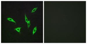 Immunofluorescence analysis of LOVO cells using Anti-ADORA2B Antibody The right hand panel represents a negative control, where the antibody was pre-incubated with the immunising peptide