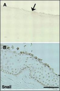 Anti-SNAI1 Rabbit Polyclonal Antibody