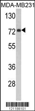 Anti-FMO3 Rabbit Polyclonal Antibody