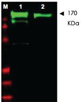 Anti-EGFR Rabbit Polyclonal Antibody