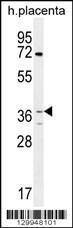 Anti-OR2AT4 Rabbit Polyclonal Antibody (Biotin)