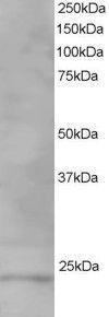 Anti-VPS28 Antibody (A82678) staining (1 µg/ml) of Human Testis lysate (RIPA buffer, 35 µg total protein per lane). Primary incubated for 1 hour. Detected by chemiluminescence