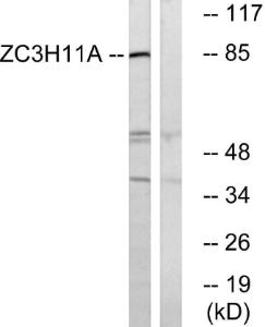 Antibody anti-ZC3H11A 100 µg