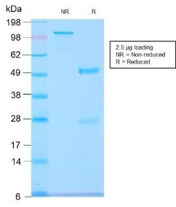 SDS-PAGE analysis of Anti-GnRHR Antibody [GNRHR/2982R] under non-reduced and reduced conditions; showing intact IgG and intact heavy and light chains, respectively SDS-PAGE analysis confirms the integrity and purity of the antibody