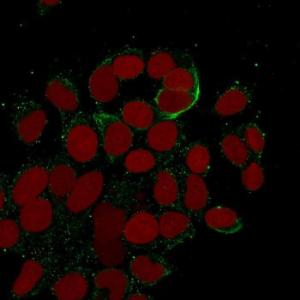 Immunofluorescent analysis of methanol fixed MCF-7 cells stained with Anti-Cytokeratin 10 + 13 Antibody [DE-K13] followed by Goat Anti-Mouse IgG (CF&#174; 488). Nuclei counterstained with RedDot