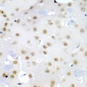 Immunohistochemistry analysis of paraffin-embedded mouse brain using Anti-Cdc27 Antibody (A11494) at a dilution of 1:200 (40x lens). Perform microwave antigen retrieval with 10 mM PBS buffer pH 7.2 before commencing with IHC staining protocol.