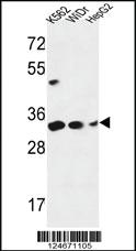 Anti-PYCR1 Rabbit Polyclonal Antibody