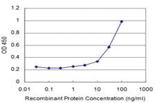 Anti-SMAD6 Mouse Monoclonal Antibody [clone: 2A6]